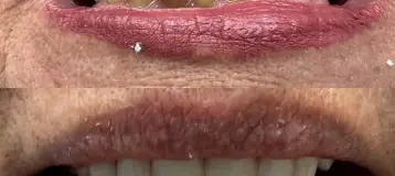 Brilliant Smiles Dental