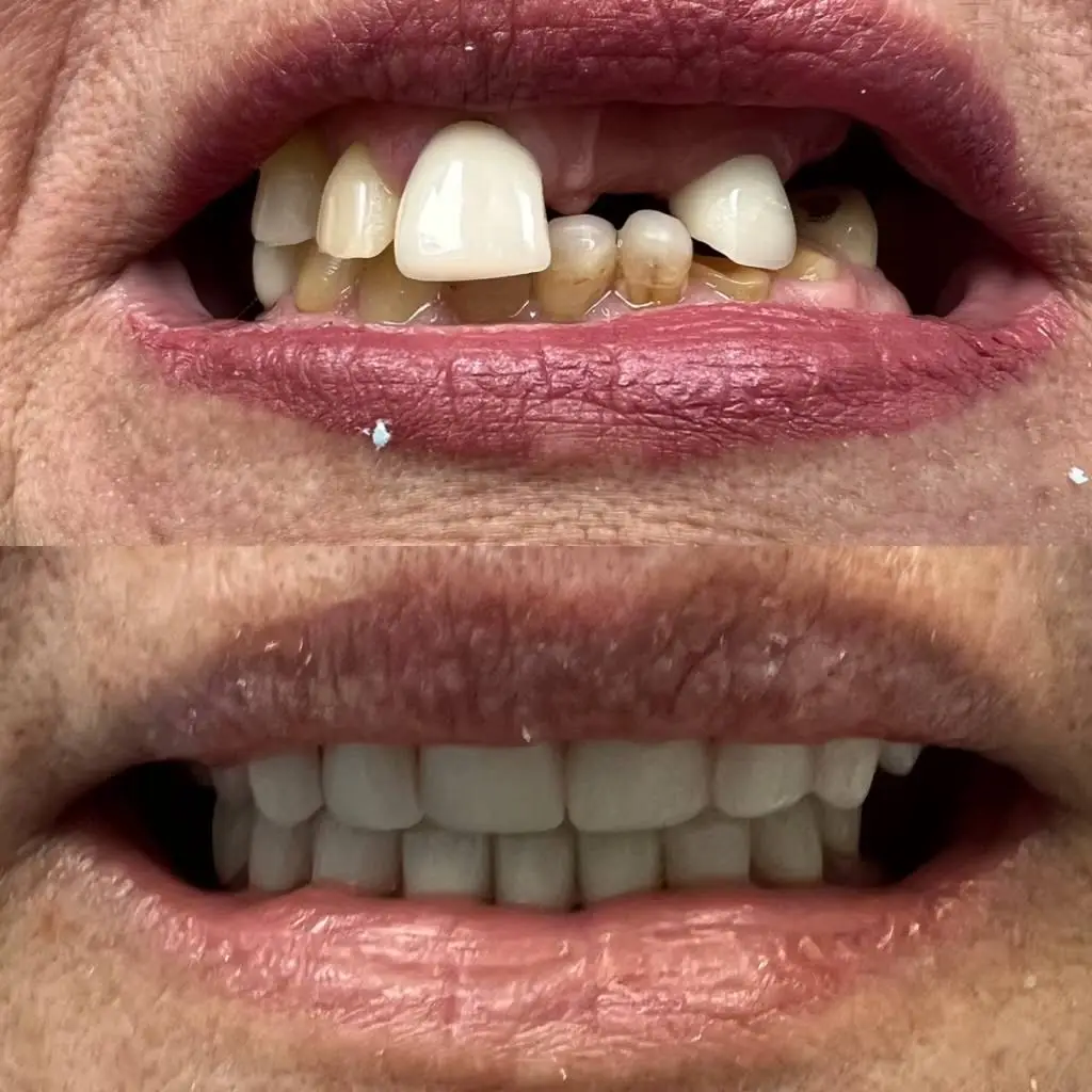 Brilliant Smiles Dental - Professional dental clinic exterior with modern facilities