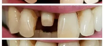 Nicolas Fakhoury D.M.D. at Family Dental Care