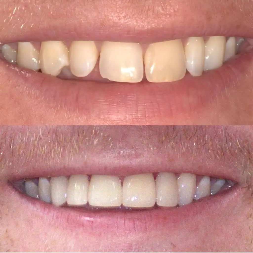 Great Boca Smiles