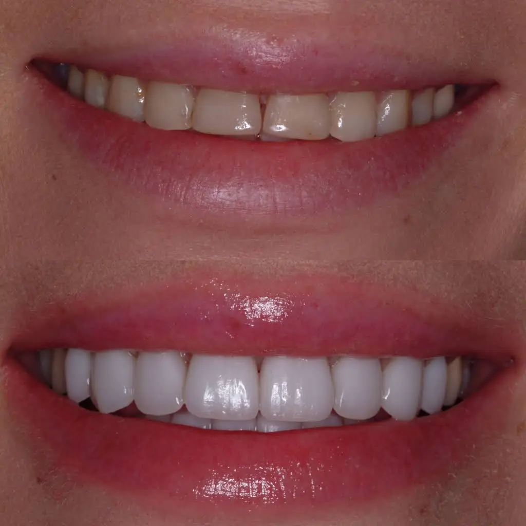 Boca Raton Cosmetic Dentist