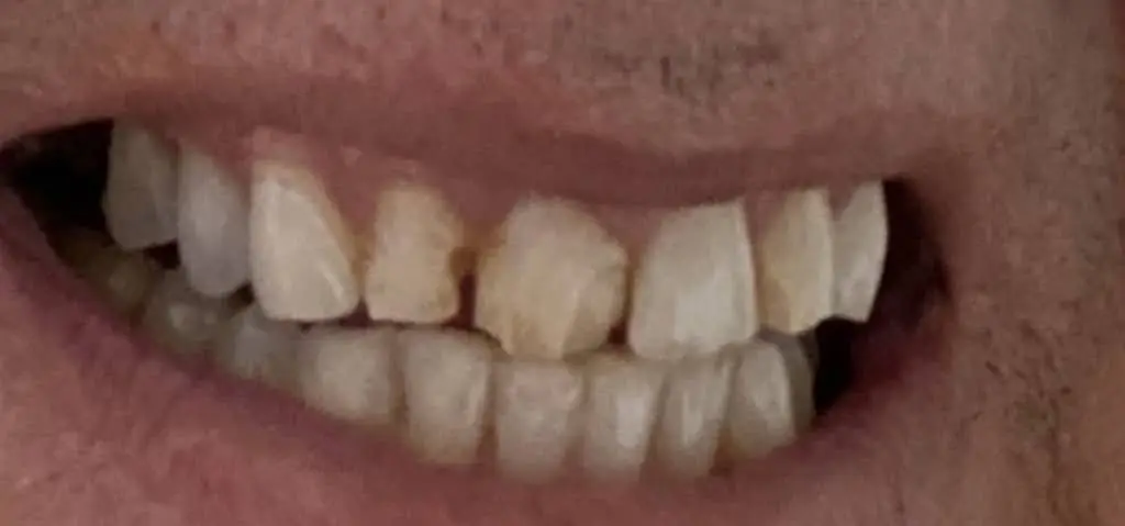 Ericsson Dental