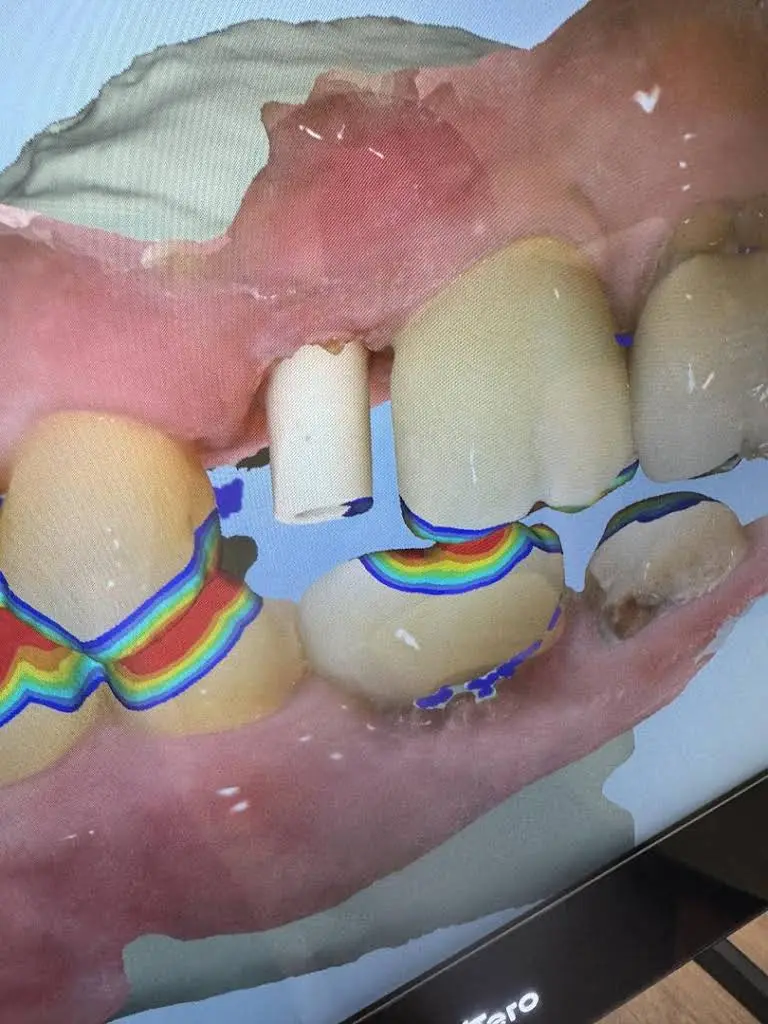 Polin Dental