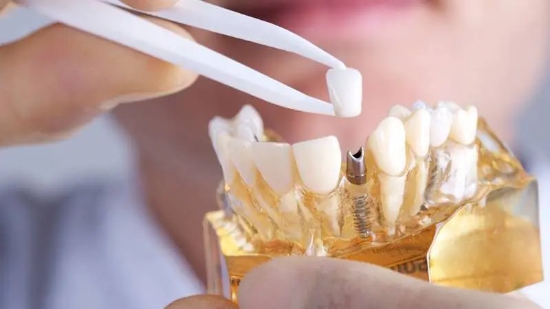 Laser and Cosmetic Dental Center of Boca Raton - Professional dental clinic exterior with modern facilities