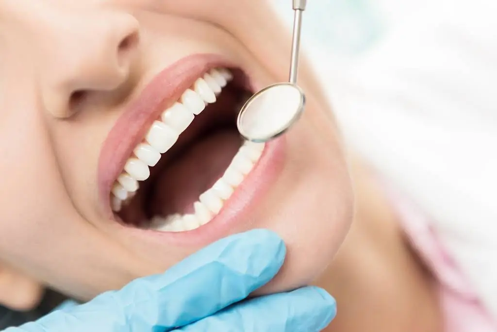 BOCA DENTAL
