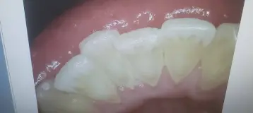 Smile Design Dentistry