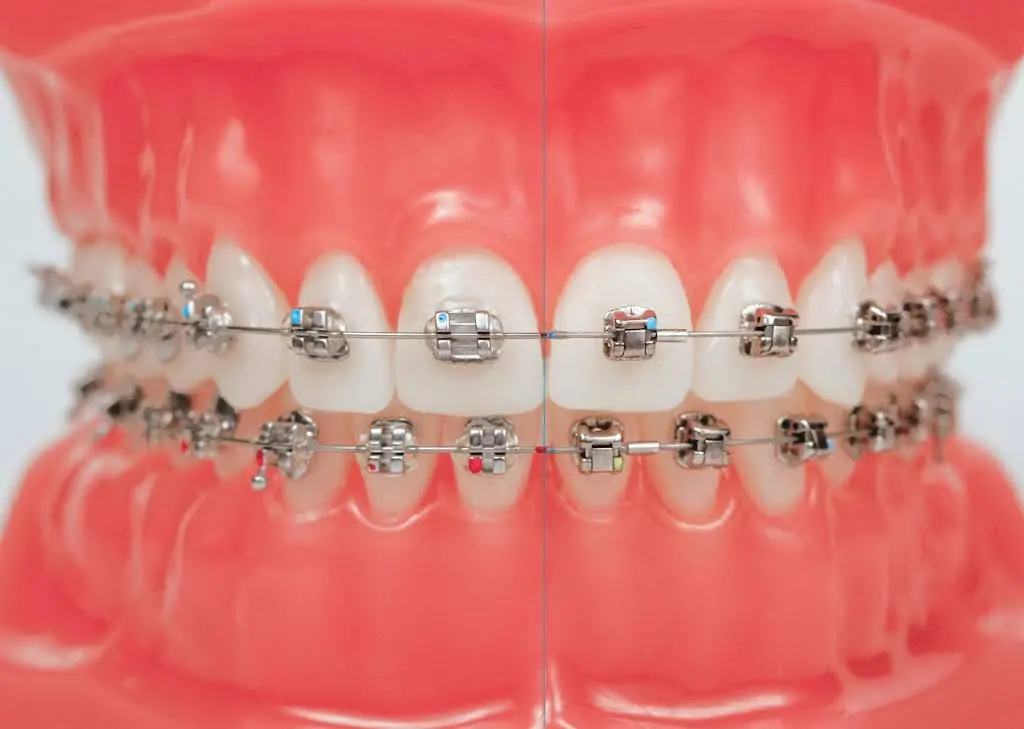 OrthoMike Orthodontics
