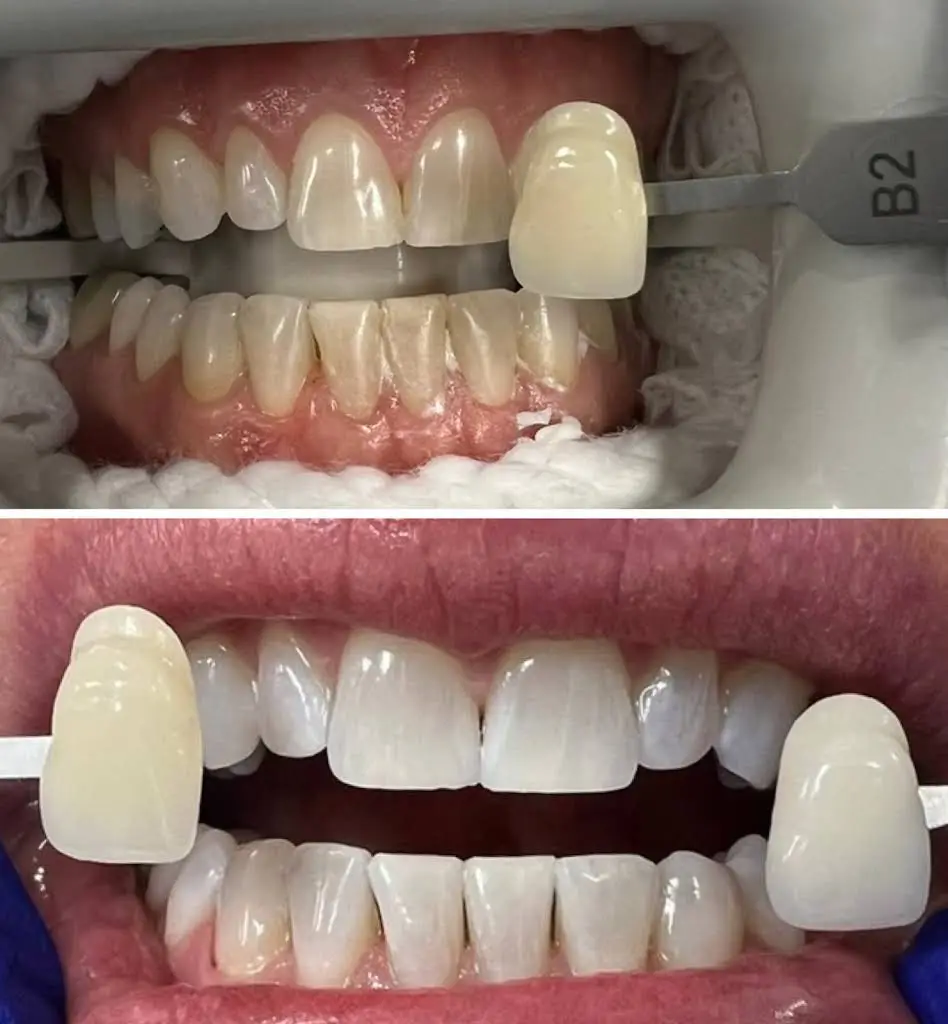 Boca Dental Group