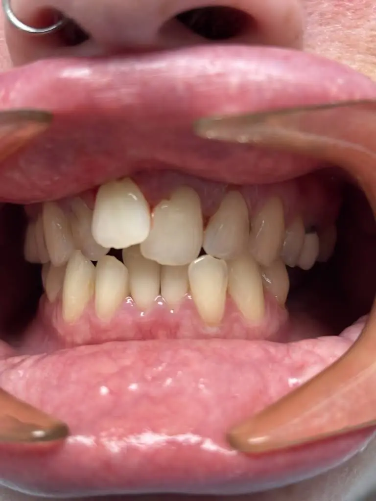 Blumenthal and Bartels Dentistry