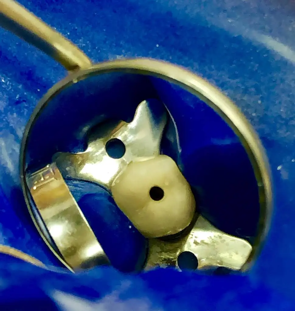 Jordan L. Schapiro D.D.S. Endodontics