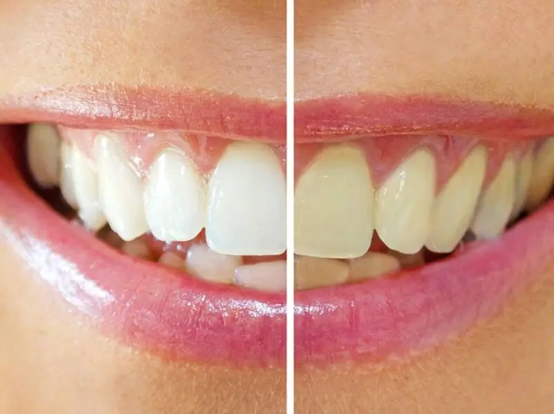 Dental Fix