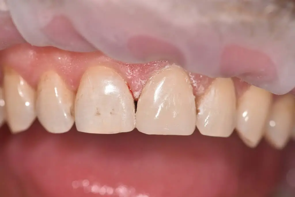 Avak Aesthetic Dentistry