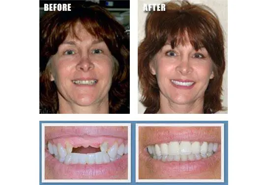 Emergency Dental & Dentures 24-7