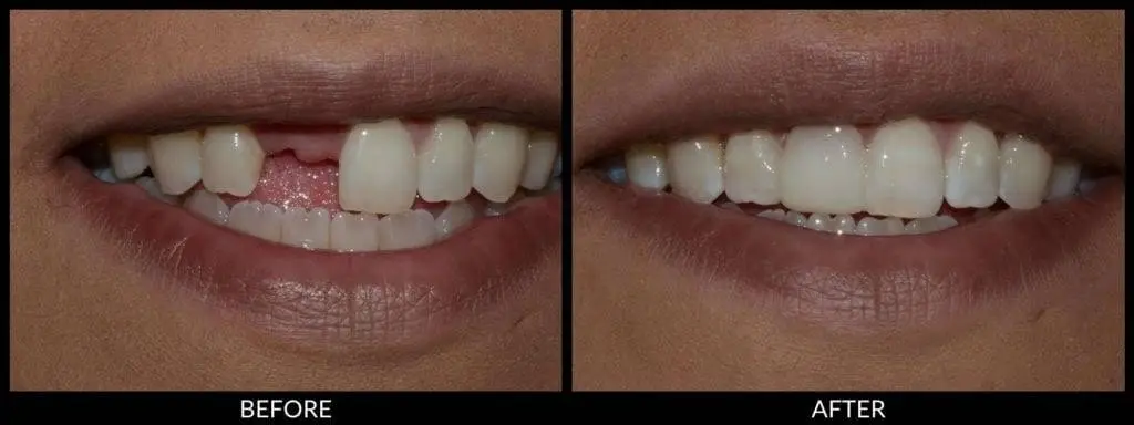 Emergency Dental & Dentures 24-7