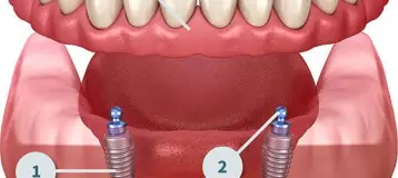 Emergency Dentist & Dentures 24-7