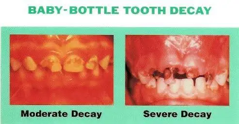 Pompano Family Dental