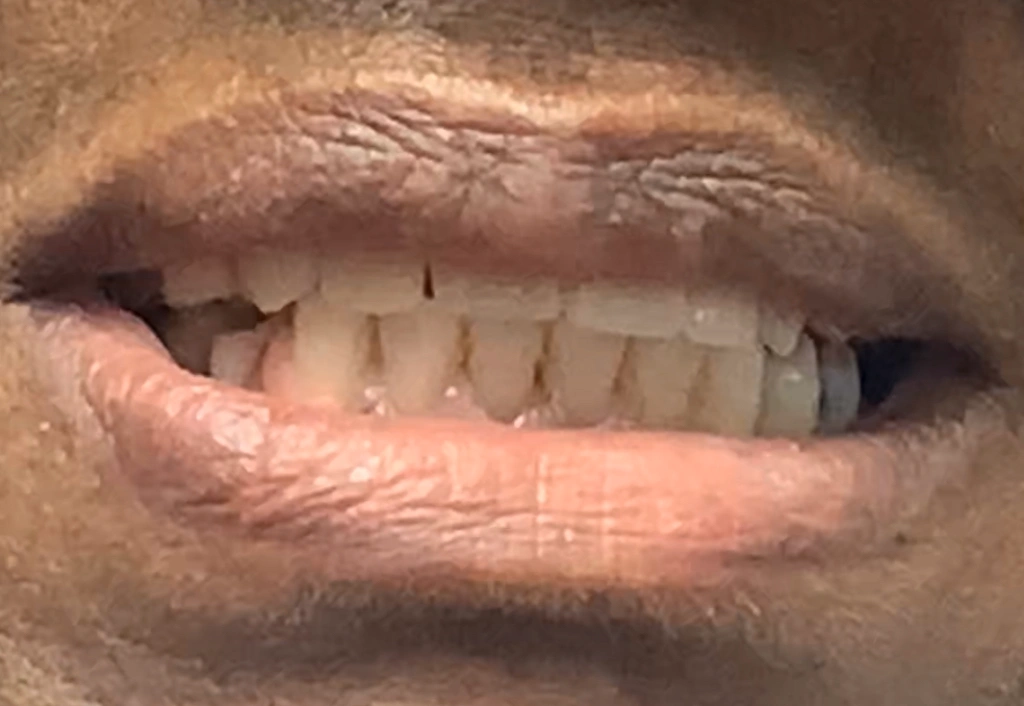 William A Forero DMD - Dental Implants Coral Springs