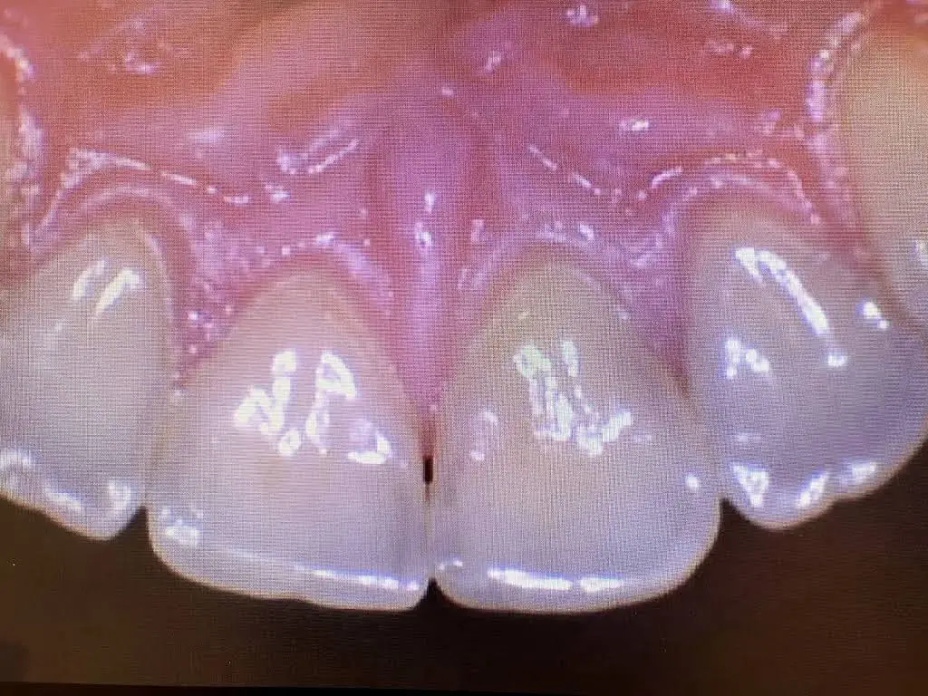 Pine Ridge Dental on Wiles