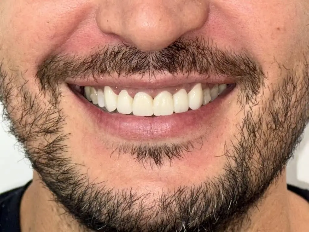Rey Dental