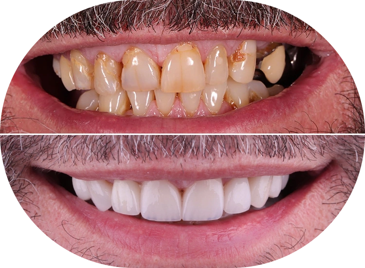 Rey Dental