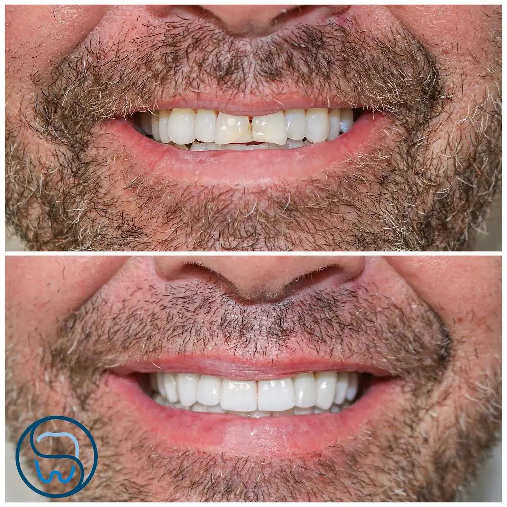 Rey Dental