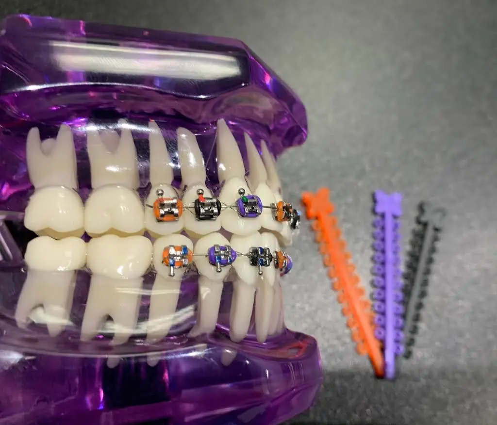 Smile Clinic of Coral Springs Orthodontics