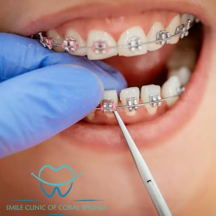 Smile Clinic of Coral Springs Orthodontics