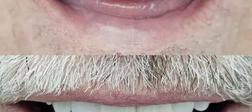 Coconut Creek Cosmetic and Implant Dentistry