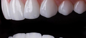 Affordable Dentistry of Coral Springs