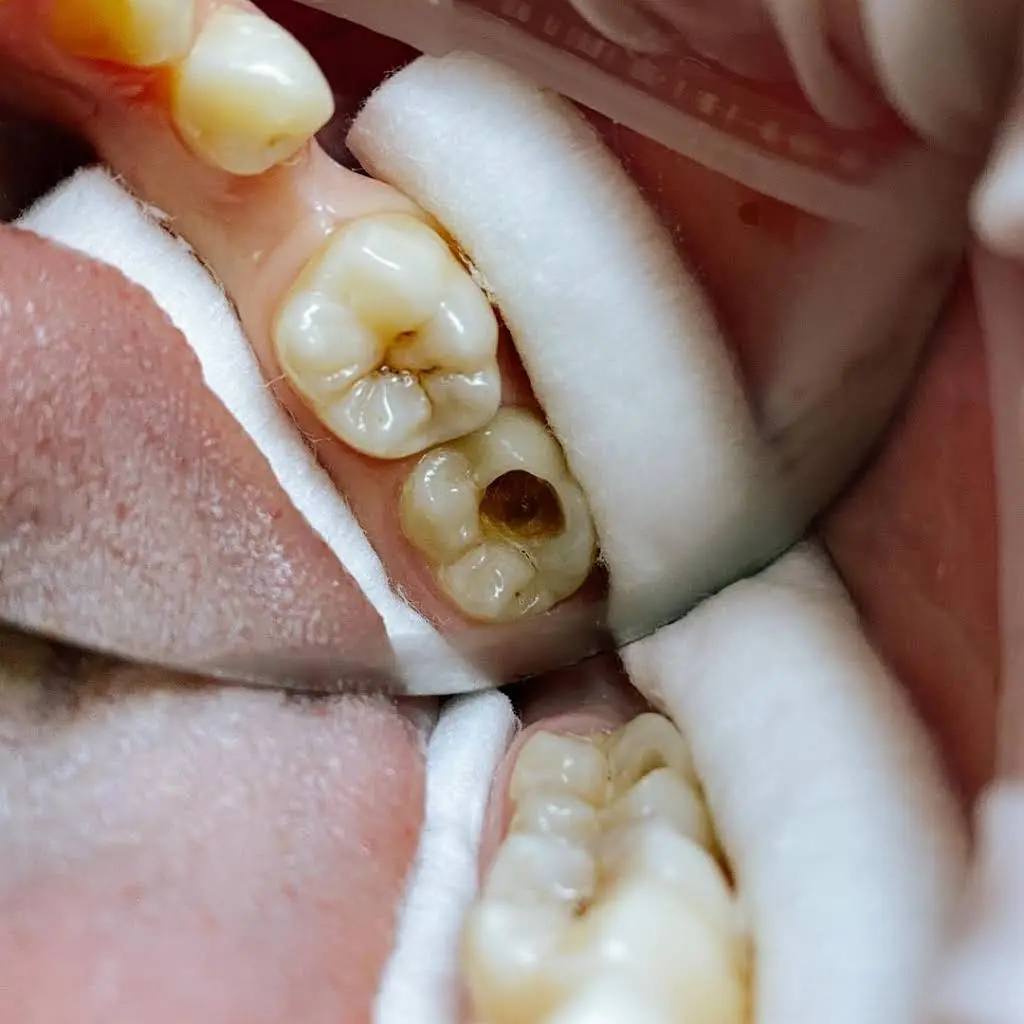 Affordable Dentistry of Coral Springs