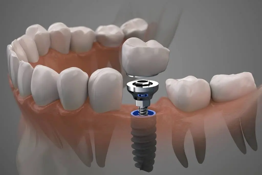 Affordable Dentistry of Coral Springs