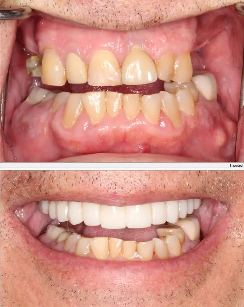 Restorative and Implant Dentistry Pompano Beach