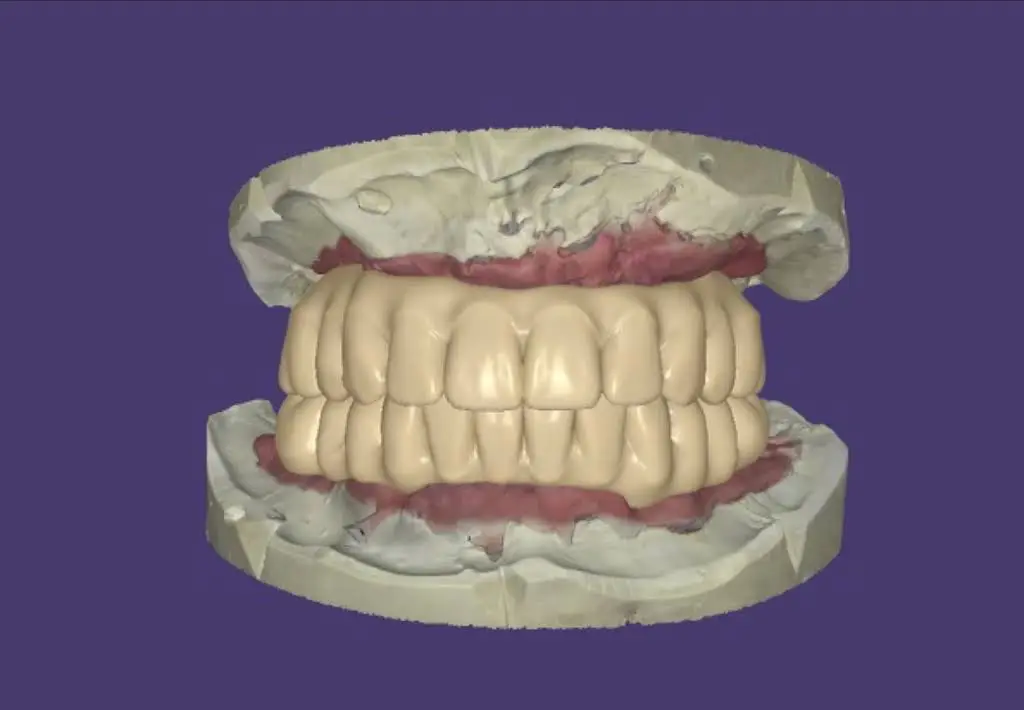 Restorative and Implant Dentistry Pompano Beach