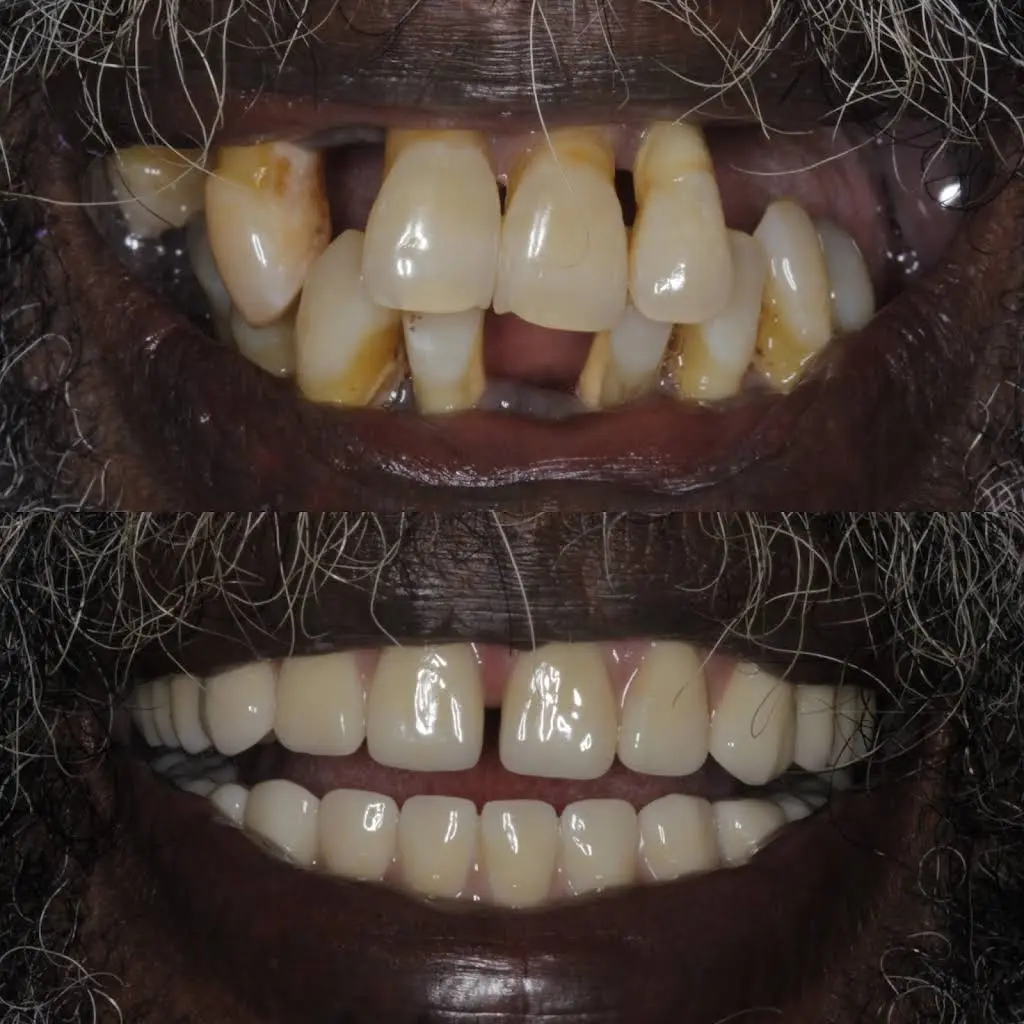 Restorative and Implant Dentistry Pompano Beach