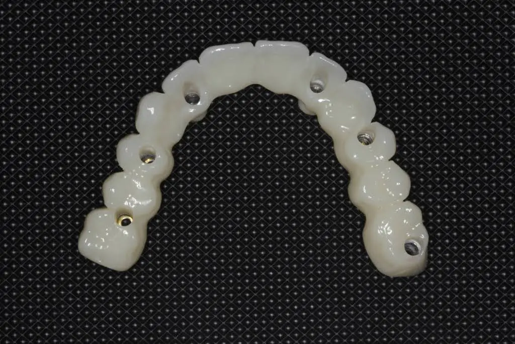 Restorative and Implant Dentistry Pompano Beach