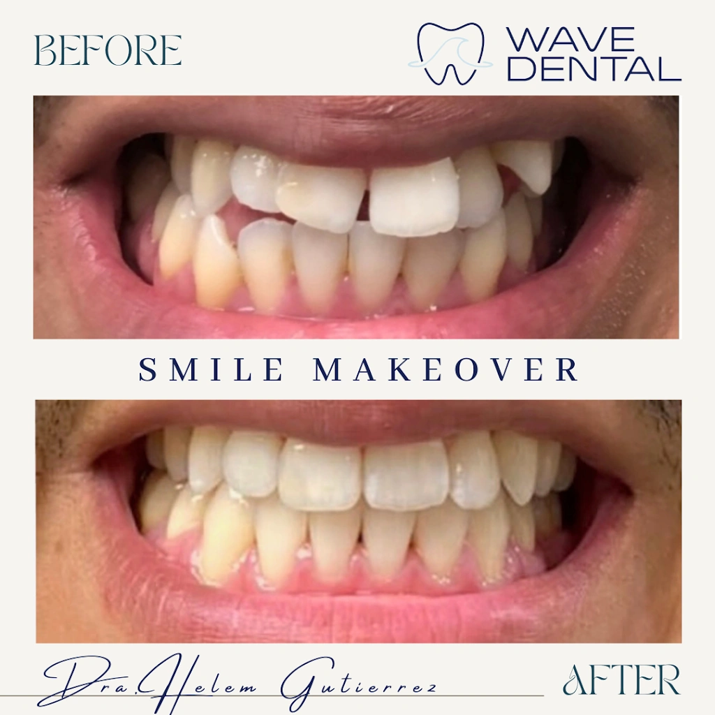Wave Dental