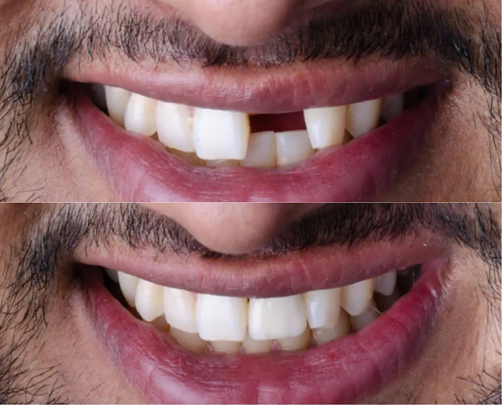 America's Bright Smiles