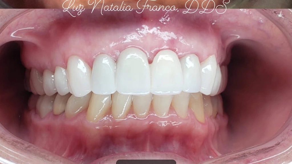 The Dental Place of Tamarac - Professional dental clinic exterior with modern facilities