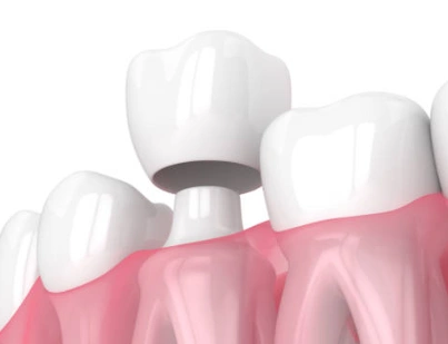Jaline Boccuzzi, DMD, AAACD, PA / JBDentistry
