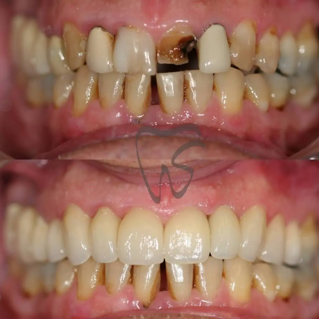 Stanton Smiles