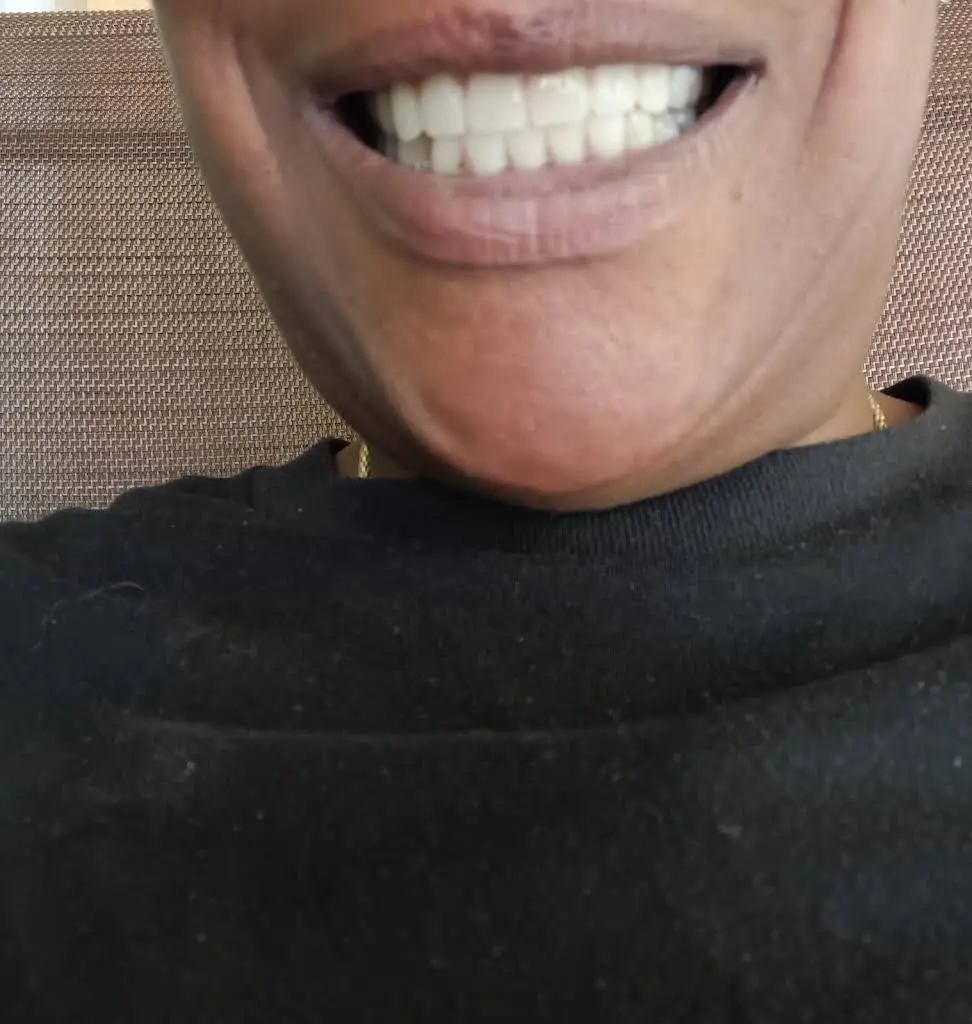 Best Value Dentures and Implants