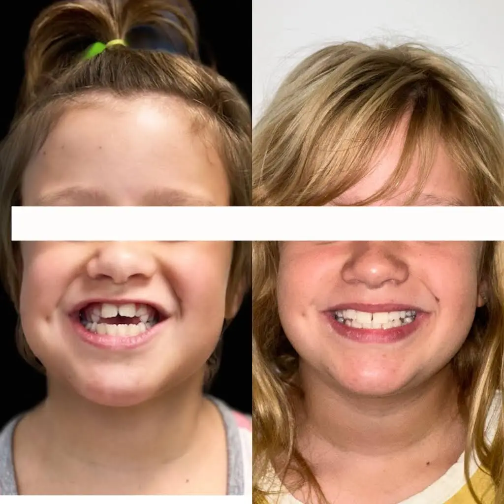 Kids Healthy Smiles
