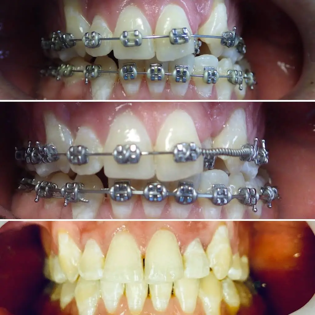 Kids Healthy Smiles