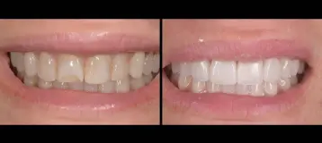 Beauty and the Teeth Dentistry