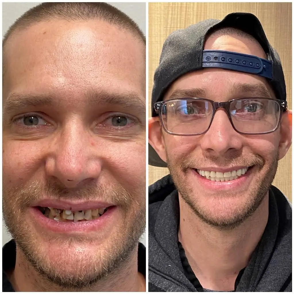 Renew Family Dental