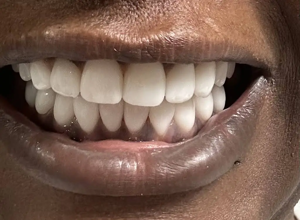 GDG Smiles