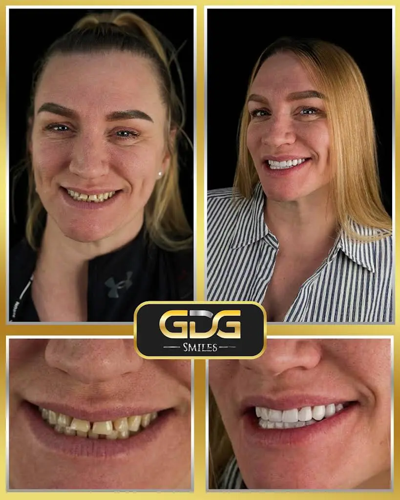GDG Smiles
