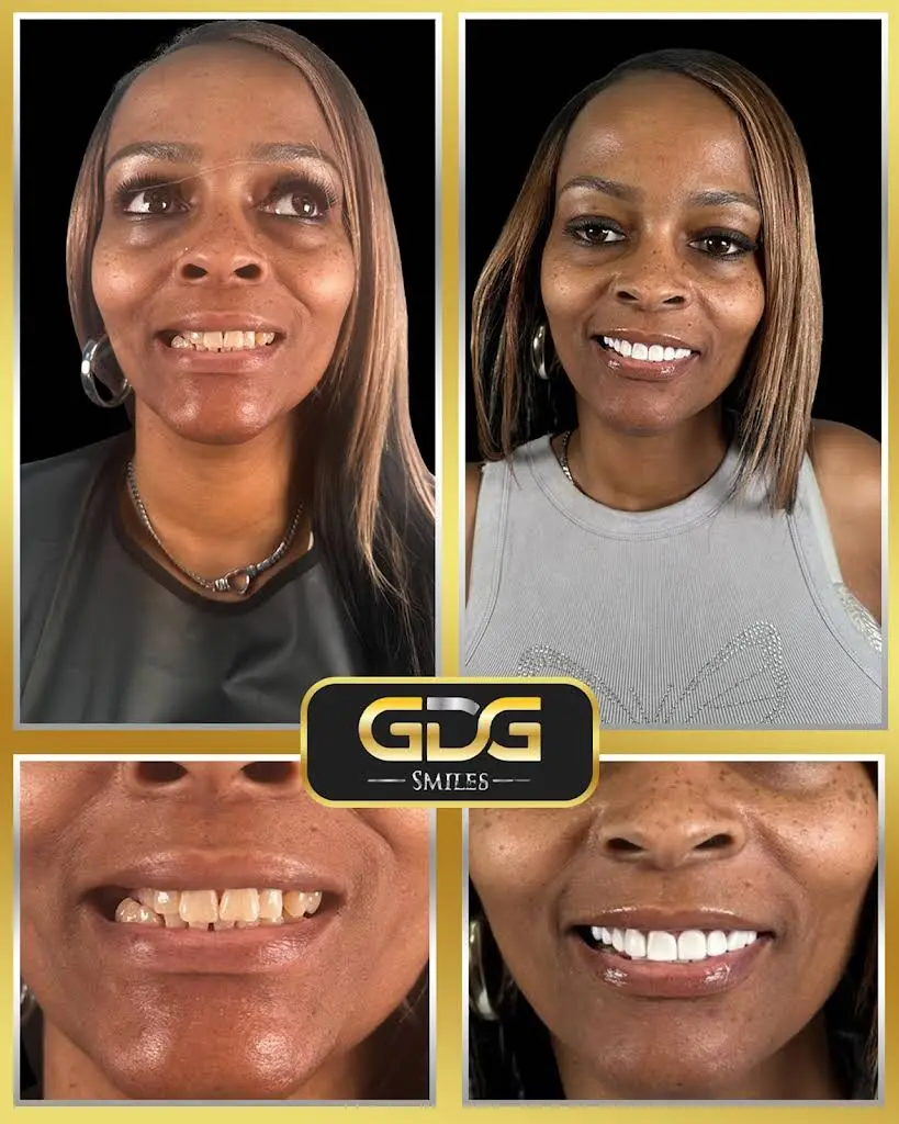 GDG Smiles