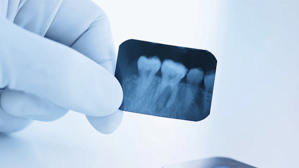 Dental Smiles Lauderhill