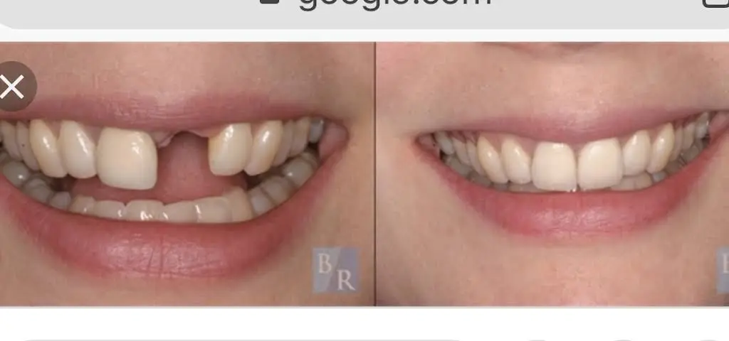 Dental Smiles Lauderhill